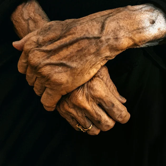 The Anatomy of Aging Hazards